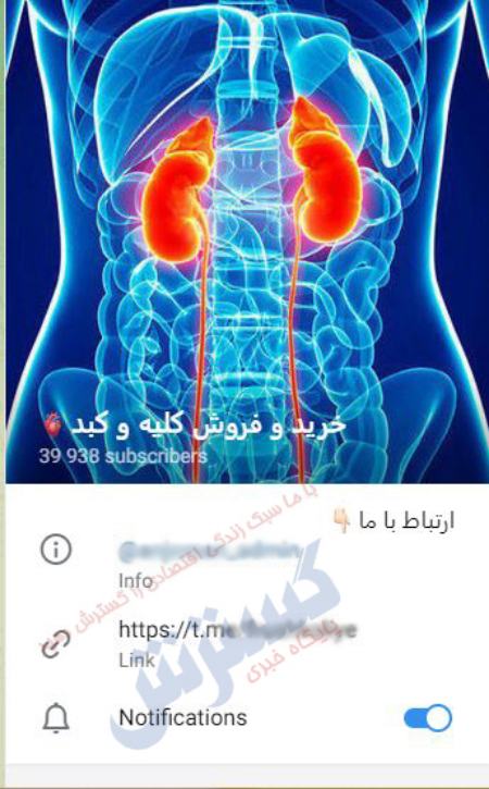 بازار سیاه فروش اعضای حیاتی بدن،اخبار اجتماعی،خبرهای اجتماعی