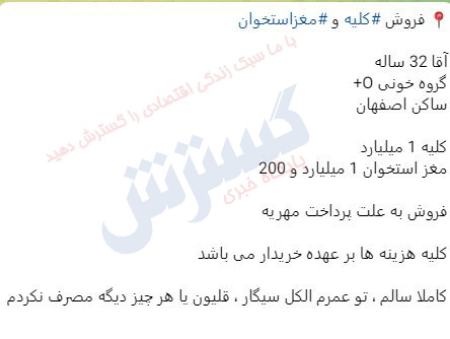 بازار سیاه فروش اعضای حیاتی بدن،اخبار اجتماعی،خبرهای اجتماعی