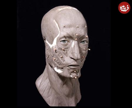 بازسازی چهره یک مرد،اخبار گوناگون،خبرهای گوناگون