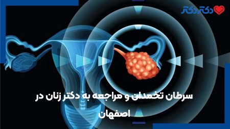 سرطان تخمدان و مراجعه به دکتر زنان در اصفهان