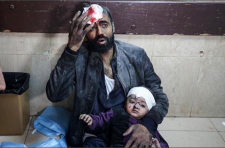 عکسهای جالب,عکسهای جذاب,زخمی های حملات هوایی اسراییل در بیمارستان الاقصی در دیر البلح در مرکز نوار غزه 