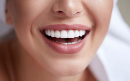 مزایای لمینت دندان چیست؟ مزایای لمینت دندان چیست؟