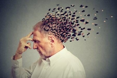 آلزایمر،اخبار پزشکی،خبرهای پزشکی