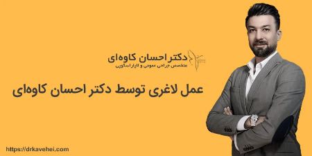 عمل لاغری توسط دکتر احسان کاوه ای عمل لاغری توسط دکتر احسان کاوه ای