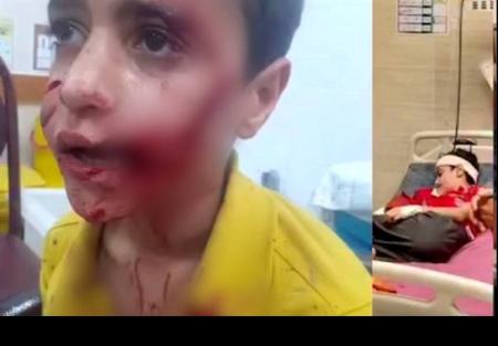 حمله سگ به کودک،اخبار حوادث،خبرهای حوادث