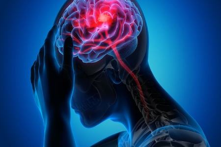 سکته مغزی،اخبار پزشکی،خبرهای پزشکی سکته مغزی،اخبار پزشکی،خبرهای پزشکی
