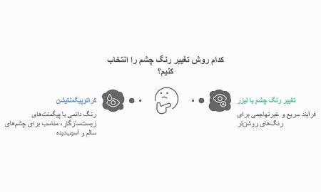 عمل تغییر رنگ چشم با لیزر عمل تغییر رنگ چشم با لیزر