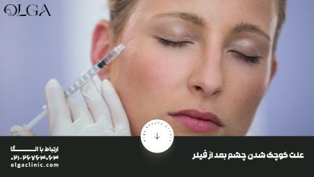 علت کوچک شدن چشم بعد از فیلر علت کوچک شدن چشم بعد از فیلر