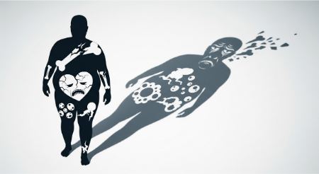 چاقی و بیماریهای قلبی-عروقی چاقی و بیماریهای قلبی-عروقی