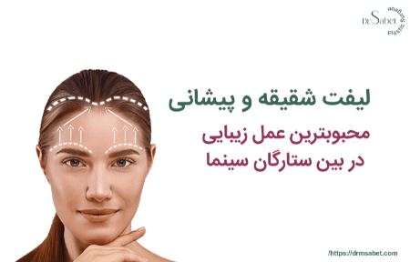 لیفت شقیقه و پیشانی با دکتر محمد ثابت