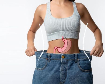 کاهش وزن بعد از عمل اسلیو