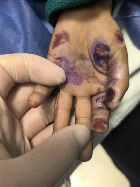 کودکآزاری منجر به فوت در هرمزگان،اخبار حوادث،خبرهای حوادث کودکآزاری منجر به فوت در هرمزگان،اخبار حوادث،خبرهای حوادث