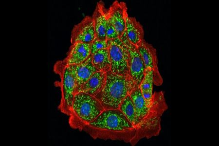 بیماری کلیوی،اخبار پزشکی،خبرهای پزشکی بیماری کلیوی،اخبار پزشکی،خبرهای پزشکی