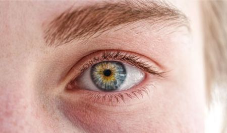 علت سیاهی دور چشم چیست علت سیاهی دور چشم چیست