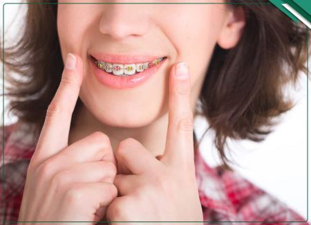تاثیر ارتودنسی بر زیبایی