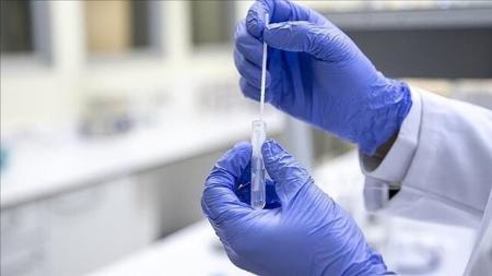 آنفلوآنزا،اخبار پزشکی،خبرهای پزشکی