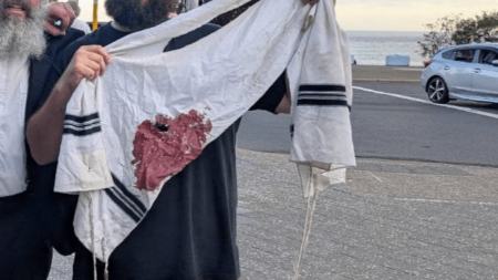 تیراندازی در جریان یک جشن یهودیان در استرالیا،اخبار بین الملل،خبرهای بین الملل تیراندازی در جریان یک جشن یهودیان در استرالیا،اخبار بین الملل،خبرهای بین الملل