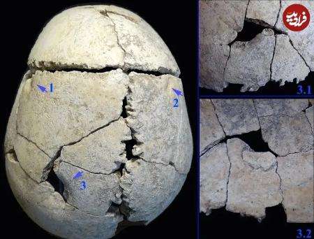 اسکلت،اخبار گوناگون،خبرهای گوناگون اسکلت،اخبار گوناگون،خبرهای گوناگون