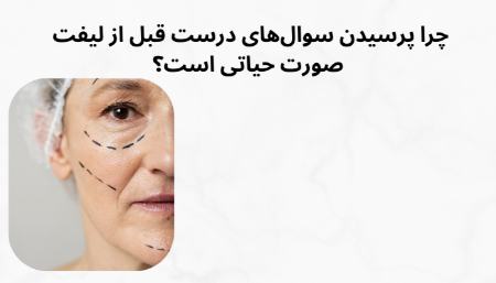 اهمیت پرسیدن سوالات مربوط به جراحی لیفت صورت اهمیت پرسیدن سوالات مربوط به جراحی لیفت صورت