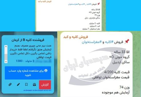 فروش کلیه،اخبار اجتماعی،خبرهای اجتماعی