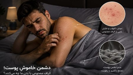 دشمن خاموش پوست | آسیبهای الیاف مصنوعی به پوست؛ آکنه مکانیکا و برهم خوردن میکروبیوم دشمن خاموش پوست | آسیبهای الیاف مصنوعی به پوست؛ آکنه مکانیکا و برهم خوردن میکروبیوم