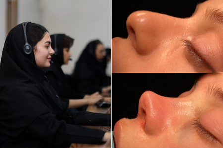 مراحل عمل بینی با پزشک 24 چگونه است؟ مراحل عمل بینی با پزشک 24 چگونه است؟