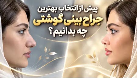 مقایسه قبل و بعد جراحی بینی گوشتی و اهمیت انتخاب بهترین جراح بینی گوشتی برای رسیدن به نتیجه طبیعی و متناسب با چهره مقایسه قبل و بعد جراحی بینی گوشتی و اهمیت انتخاب بهترین جراح بینی گوشتی برای رسیدن به نتیجه طبیعی و متناسب با چهره
