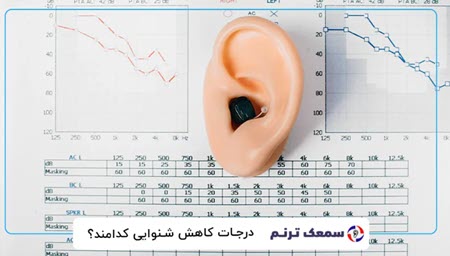 تکنولوژیهای نوین در تجویز و تنظیم انواع سمعکهای هوشمند تکنولوژیهای نوین در تجویز و تنظیم انواع سمعکهای هوشمند