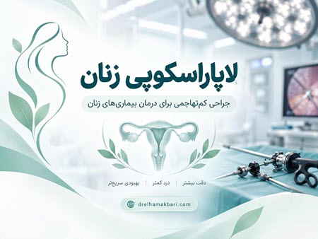 لاپاراسکوپی زنان لاپاراسکوپی زنان
