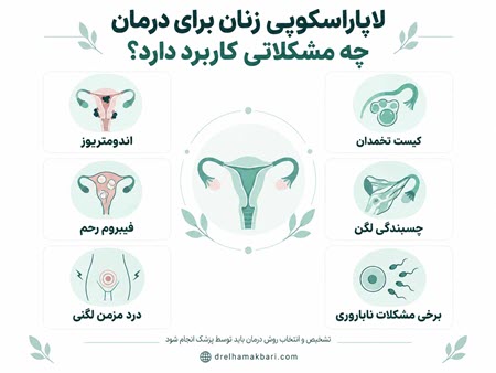 لاپاروسکوپی زنان برای درمان چه مشکلاتی کاربرد دارد لاپاروسکوپی زنان برای درمان چه مشکلاتی کاربرد دارد