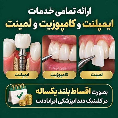 ایمپلنت، کامپوزیت یا لمینت، هر کدام برای چه مشکلی مناسب هستند؟