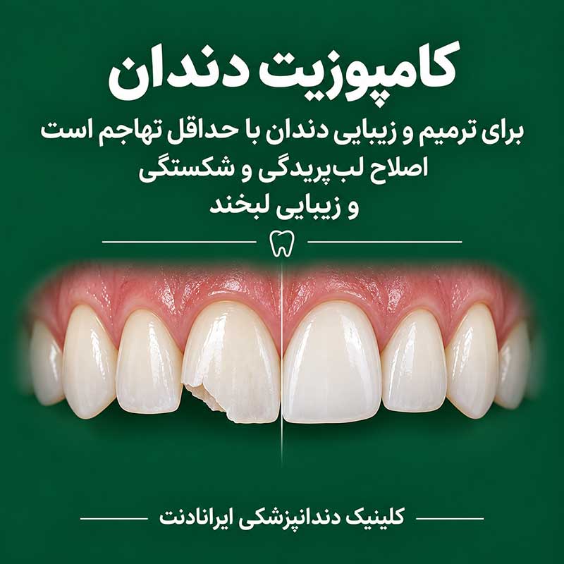 اگر دندان وجود دارد، یکی از راهکارها کامپوزیت دندان است؟