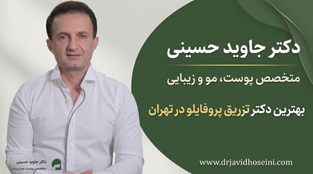 دکتر جاوید حسینی، بهترین دکتر تزریق پروفایلو در تهران دکتر جاوید حسینی، بهترین دکتر تزریق پروفایلو در تهران
