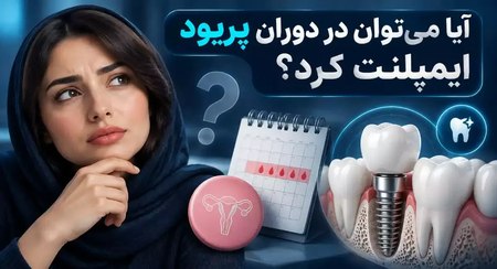 ایمپلنت در دوران قاعدگی ایمپلنت در دوران قاعدگی