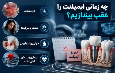 چه زمانی بهتر است ایمپلنت به تعویق بیفتد؟ چه زمانی بهتر است ایمپلنت به تعویق بیفتد؟