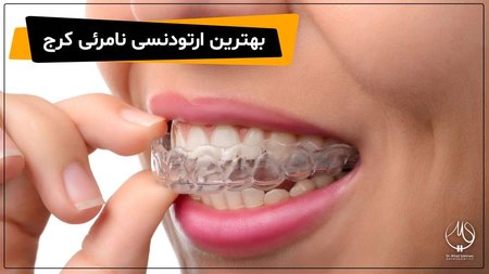 دکتر سلیمانی |متخصص ارتودنسی در کرج با شرایط اقساطی دکتر سلیمانی |متخصص ارتودنسی در کرج با شرایط اقساطی