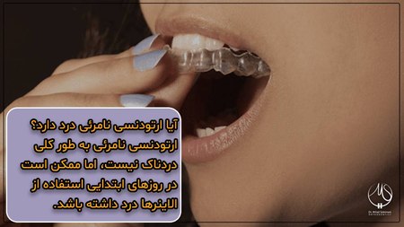 آیا ارتودنسی نامرئی دردناک است؟ آیا ارتودنسی نامرئی دردناک است؟