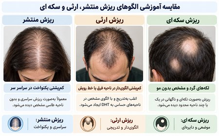 مقایسه آموزشی الگوهای ریزش منتشر، ارثی و سکهای مقایسه آموزشی الگوهای ریزش منتشر، ارثی و سکهای