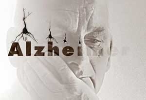 خطر آلزایمروعدم استفاده از سلول‌های مغزی در سالمندان كاهش می‌یابد