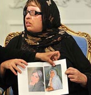 آمنه بهرامی:  پزشکان اسپانیایی نسیه جراحی ام کردند