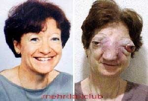 تقاضای عجیب یک زن زشت از سارکوزی+عکس