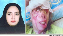 اسیدپاشی,اسید پاشیدن روی صورت,تصاویر اسیدپاشی,قربانی اسید پاشی,اخبار حوادث91,حوادث امروز  