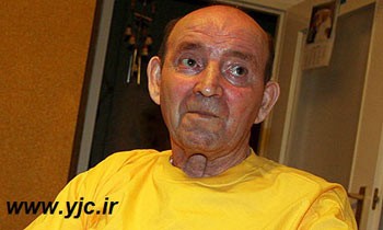 اتفاق های عجیب دنیا, عجایب دنیای پزشکی