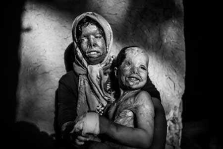 دو قربانی عشق اجباری و جنون آمیز