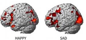 درمان بیماری‌های روانی,تشخیص شادی و غم افراد با اسکن مغزی,اسکنهای مغزی