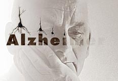 مسواک زدن,جلوگیری از آلزایمر