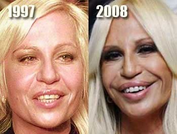 آماندا لپور,بازیگران  سینما و تلویزیون,بازیگرانی که عمل زیبایی انجام داده اند