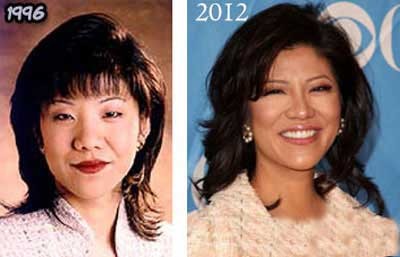 بکینسل,بازیگران  سینما و تلویزیون,بازیگرانی که عمل زیبایی انجام داده اند