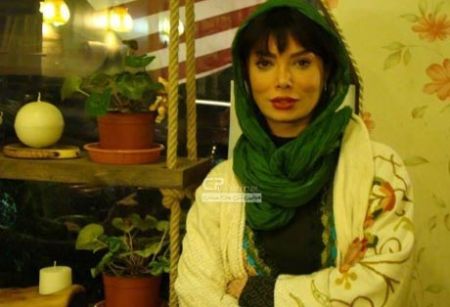 اخبار,اخبار فرهنگی,تصاویر چهره جدید نگار فروزنده,تصاویر نگار فروزنده بعد از عمل جراحی زیبایی