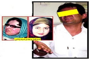 اخبار,اخباراجتماعی,قربانی اسید‌پاشی